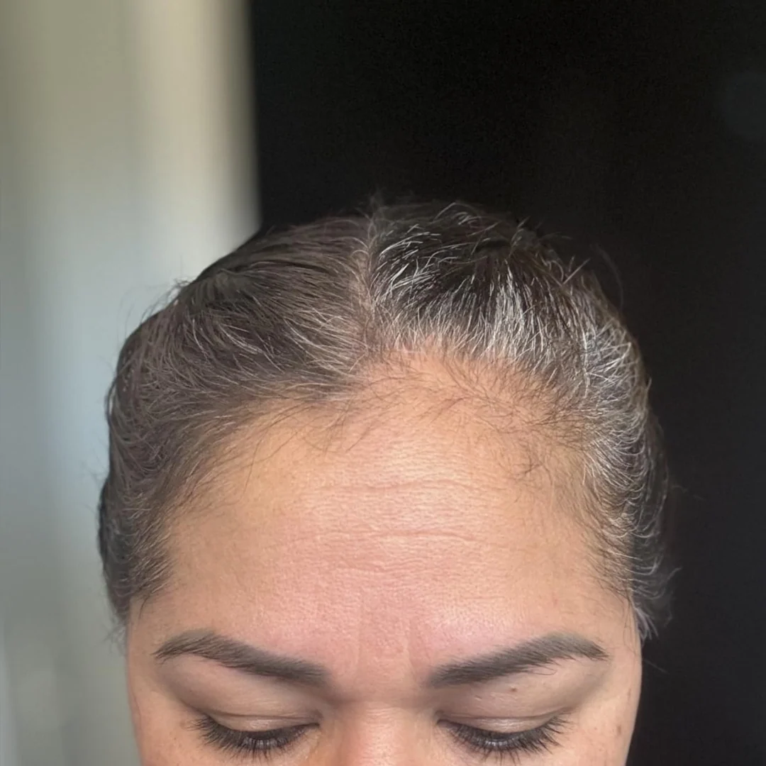 Resultado real en raíces con canas