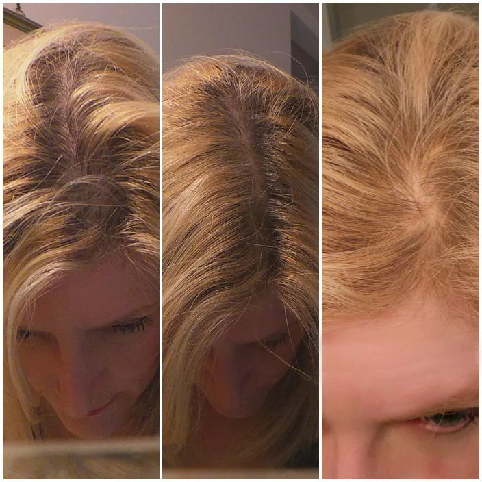 Resultado real en cabello rubio