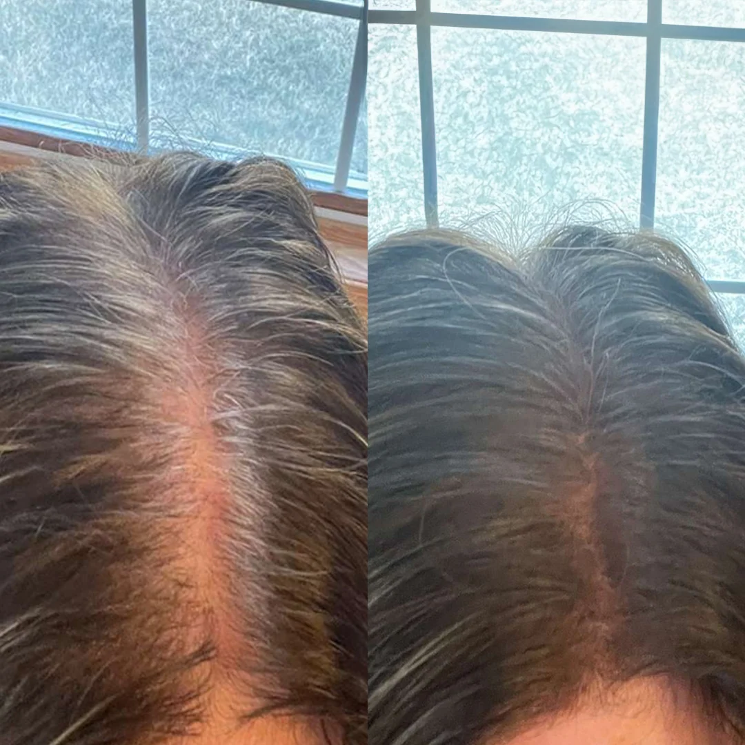 Resultado real cubriendo canas